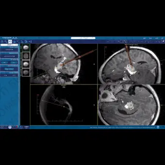 Программное обеспечение для медицинских снимков NeuroBlate  SoftwareTM NeuroBlate 