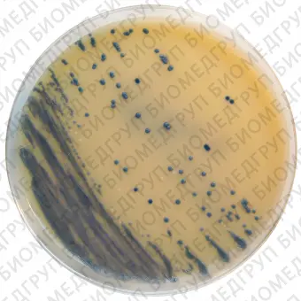 Staphylococcus aureus MRSA