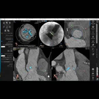 Медицинское программное обеспечение 3mensio Aortic valve