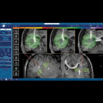 Программное обеспечение для медицинских снимков NeuroBlate  SoftwareTM NeuroBlate 