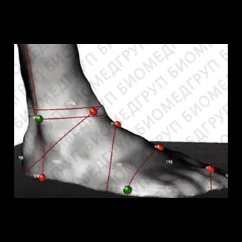 Система оценки походки Dynamic FootMorphology