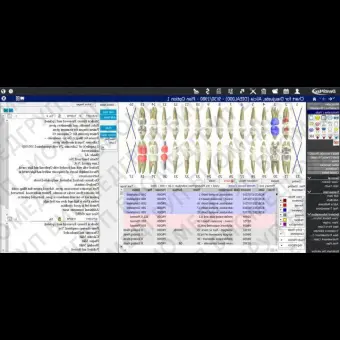 Программное обеспечение для стоматологии DentiMax