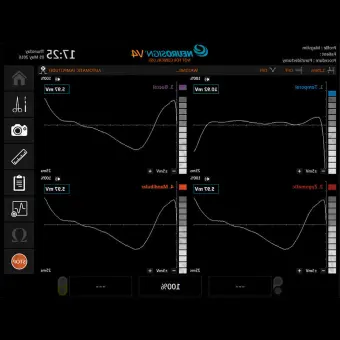 Монитор состояния нервов Neurosign V4