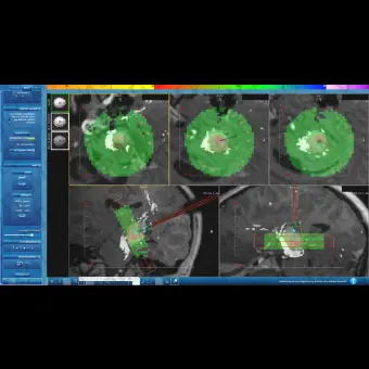 Программное обеспечение для медицинских снимков NeuroBlate  SoftwareTM NeuroBlate 