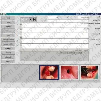 Модуль программного обеспечения для обработки снимков зубов Digitally Soft