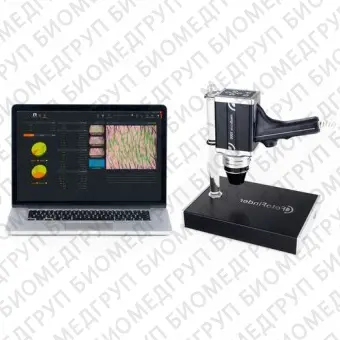 FotoFinder Dermoscope components USB Дерматоскоп