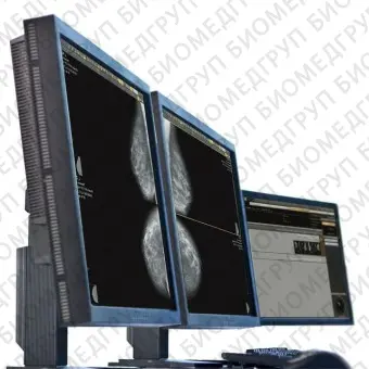 Цифровой маммограф с полным полем обзора THALIA DR