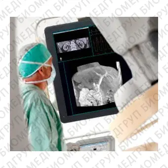 Монитор для сердечнососудистой хирургии FlexVision XL