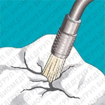 Sonicflex clean A  набор насадок и щетки Sono для профессиональной механической чистки зубов снятия зубных отложений