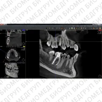 Программное обеспечение для обработки снимков зубов QuickVision 3D