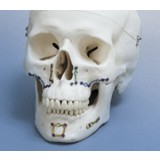 Компрессионная костная пластина для гениопластики Optimus Orthognathic System