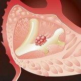 Реактив моноклональное антитело CA19-9 - Antibodies